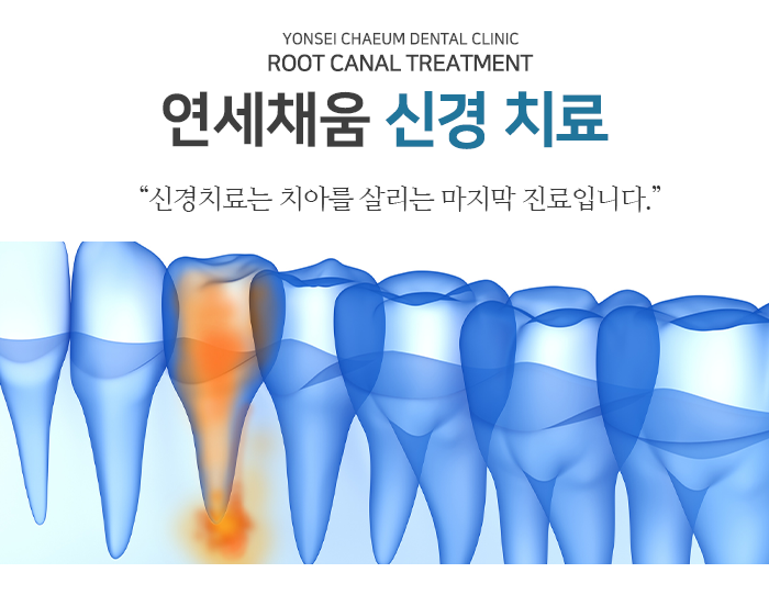 연세채움 신경 치료