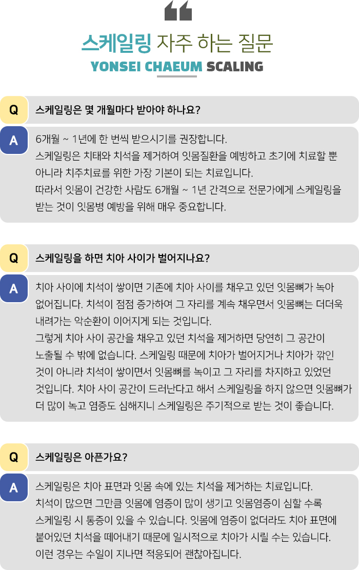 스케일링 자주 하는 질문