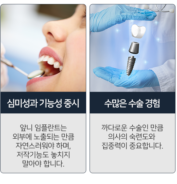 앞니임플란트-심미성과 기능성 중시, 수많은 수술 경험