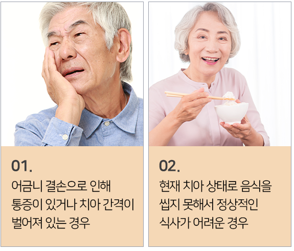 어금니 임플란트가 필요한 경우1