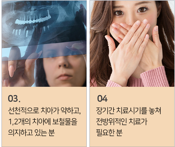 전체 임플란트가 필요한 경우2