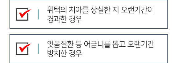 연세채움 상악동거상술 치료 추천 대상1