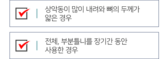 연세채움 상악동거상술 치료 추천 대상2