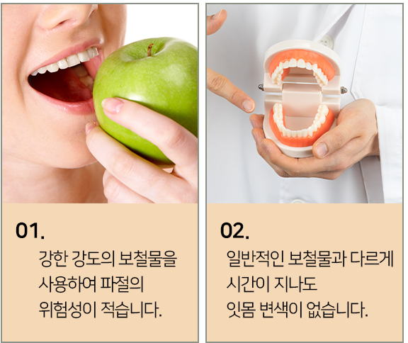 연세채움 올세라믹 장점1