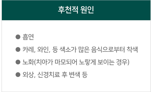 치아 변색의 후천적 원인